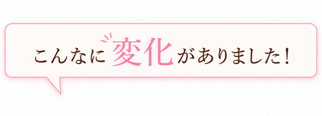 側弯症の方がこんなに変化がありました