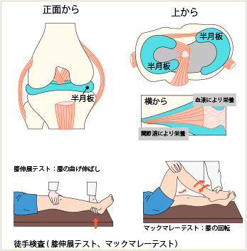 半月板損傷検査　マックマレーテスト　膝伸展テスト